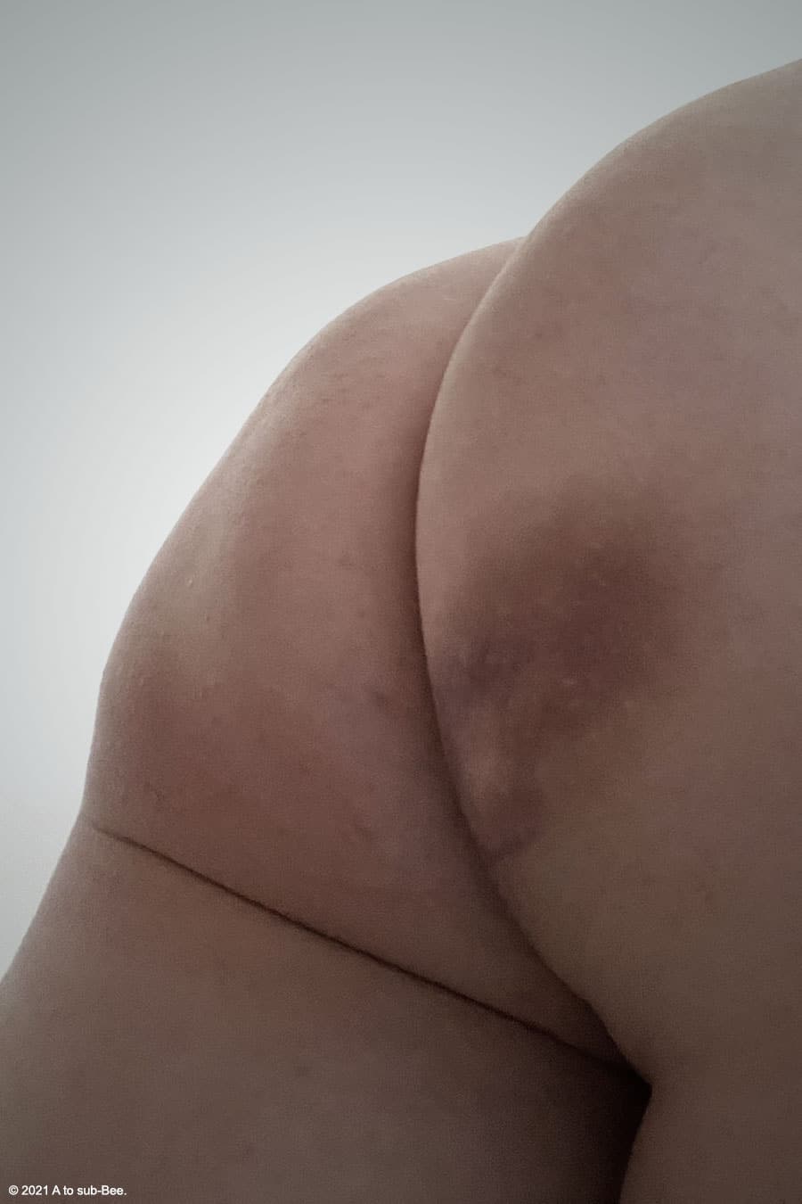 Pointy's bottom with a large bruise caused by The Keeper caning it